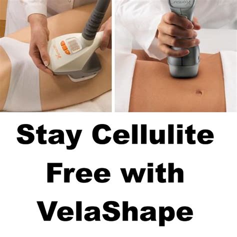 velashape reddit|VelaShape Can Help Reduce the Appearance of Cellulite  .